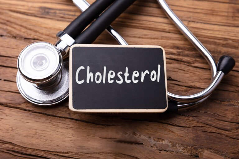 Cholesterol